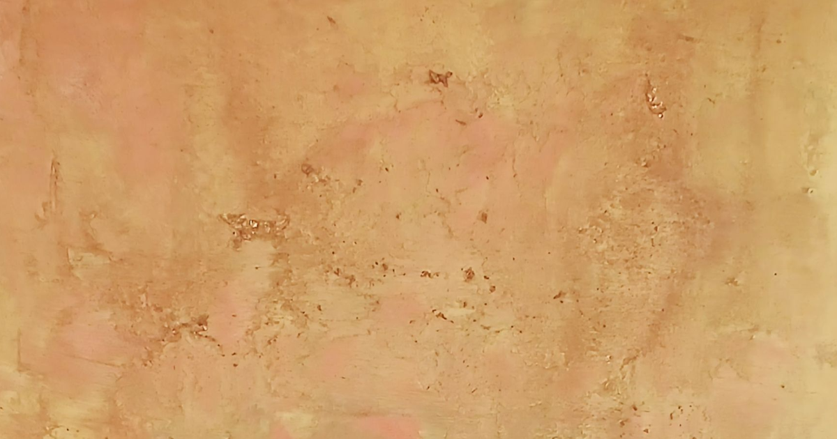 Anesthésie Réanimation, une légende biographique