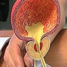 Les bienfaits de la masturbation contre le cancer de prostate