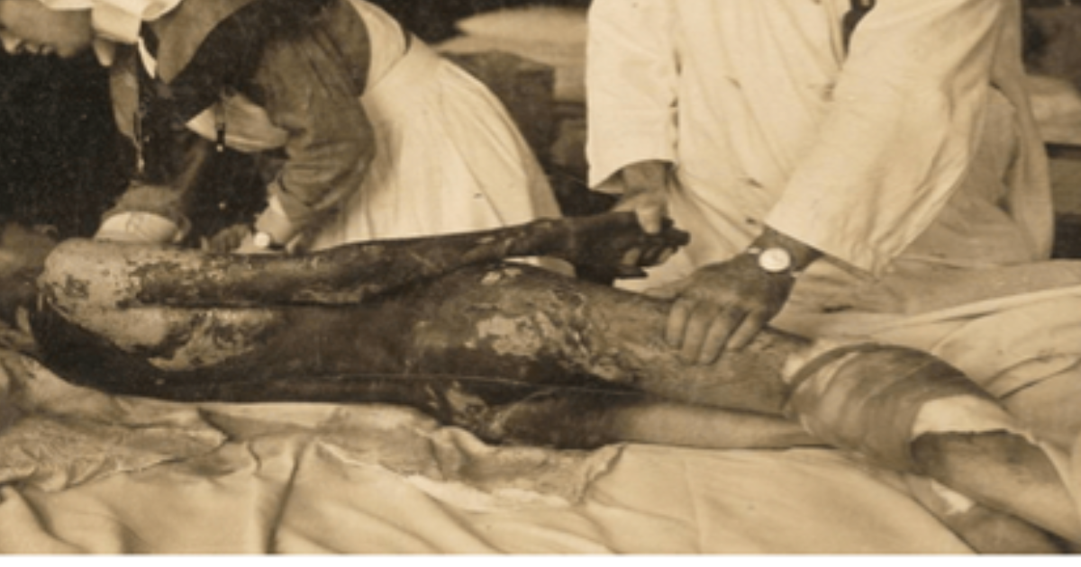 Légende et notes bas de pages ACDM