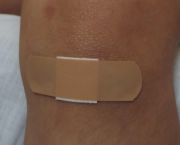 Réouvrir les plaies