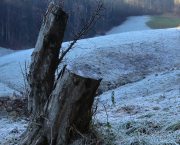 Der Dopamin-Loop und Anhedonie