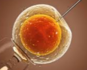 Insémination artificielle