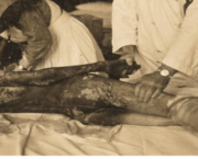 Légende et notes bas de pages ACDM