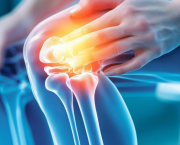 Arthrose