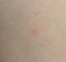 prev