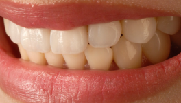 Covid, JO, Bitcoin, Météo, Netflix, Élections, Instagram, Recette, TikTok, Amazon....