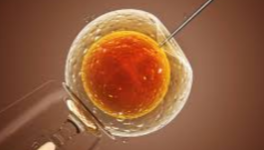 Insémination artificielle