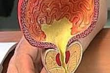 Les bienfaits de la masturbation contre le cancer de prostate