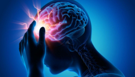  Quand migraines et céphalées deviennent mots de têtes, seul l'humour saura les faire oublier.