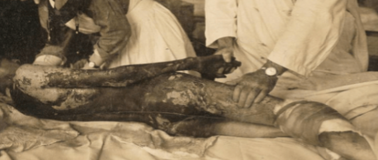 Légende et notes bas de pages ACDM