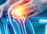 Arthrose