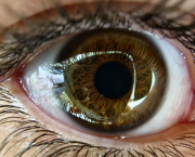 Dilatation