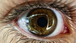 Dilatation