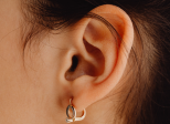 Lobe