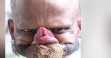 prev
