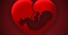 prev